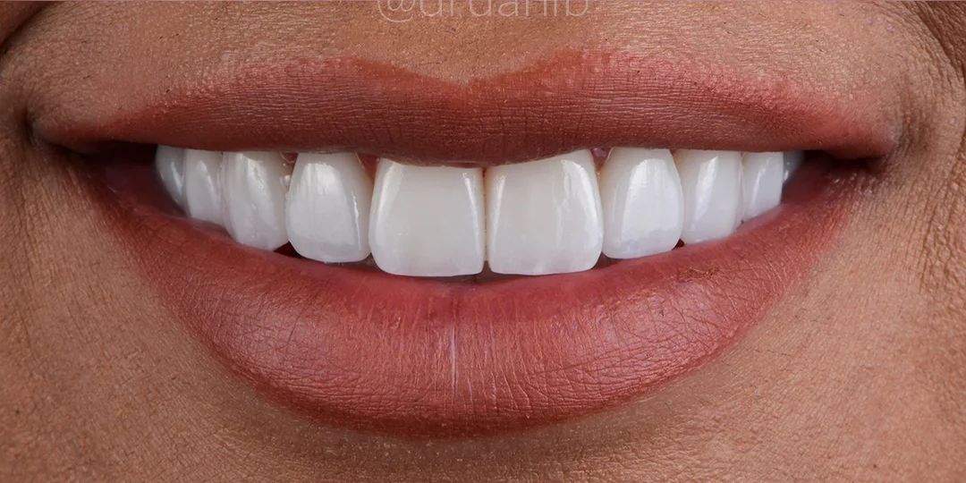 After treatment