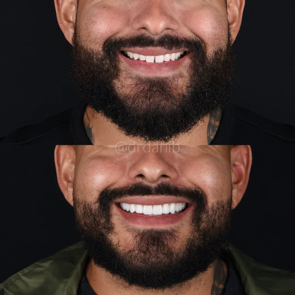 Dr. Dani B. in his Los Angeles clinic, providing expert cosmetic dentistry services, shown with state-of-the-art equipment and a focus on enhancing patient smiles through advanced dental treatments.
